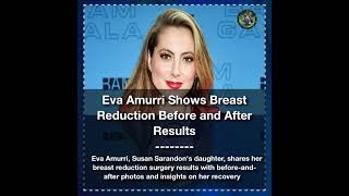 Eva Amurri Shows Breast Reduction Before and After Results