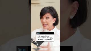 Kris Jenner is shutting down the rumors that she was unhappy with her facelift.