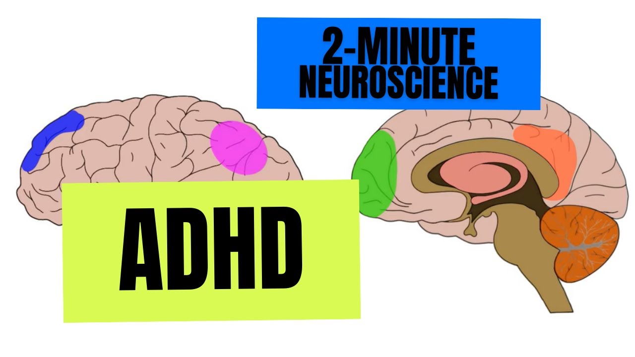 Why do some women wait decades for an ADHD diagnosis? - BBC News