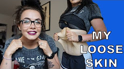 Fupa Before And After Weight Loss Fupa Before And After Weight Loss