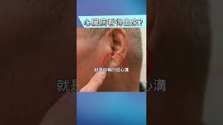 心臟病可以從指甲和耳朵看出？！