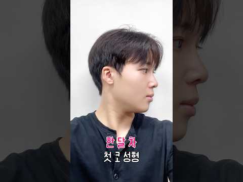 Case clip from the official Jewelry Plastic Surgery channel: 남자 코 맛집