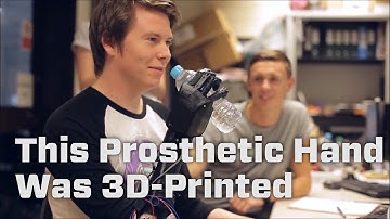 This 3D-Printed Prosthetic Costs Way Less Than Alternatives