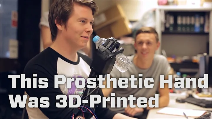 This 3D-Printed Prosthetic Costs Way Less Than Alternatives