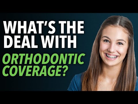 Dental Insurance 101 - Orthodontic Coverage | Holloway Benefit Concepts