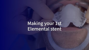 How to make your 1st Elemental stent