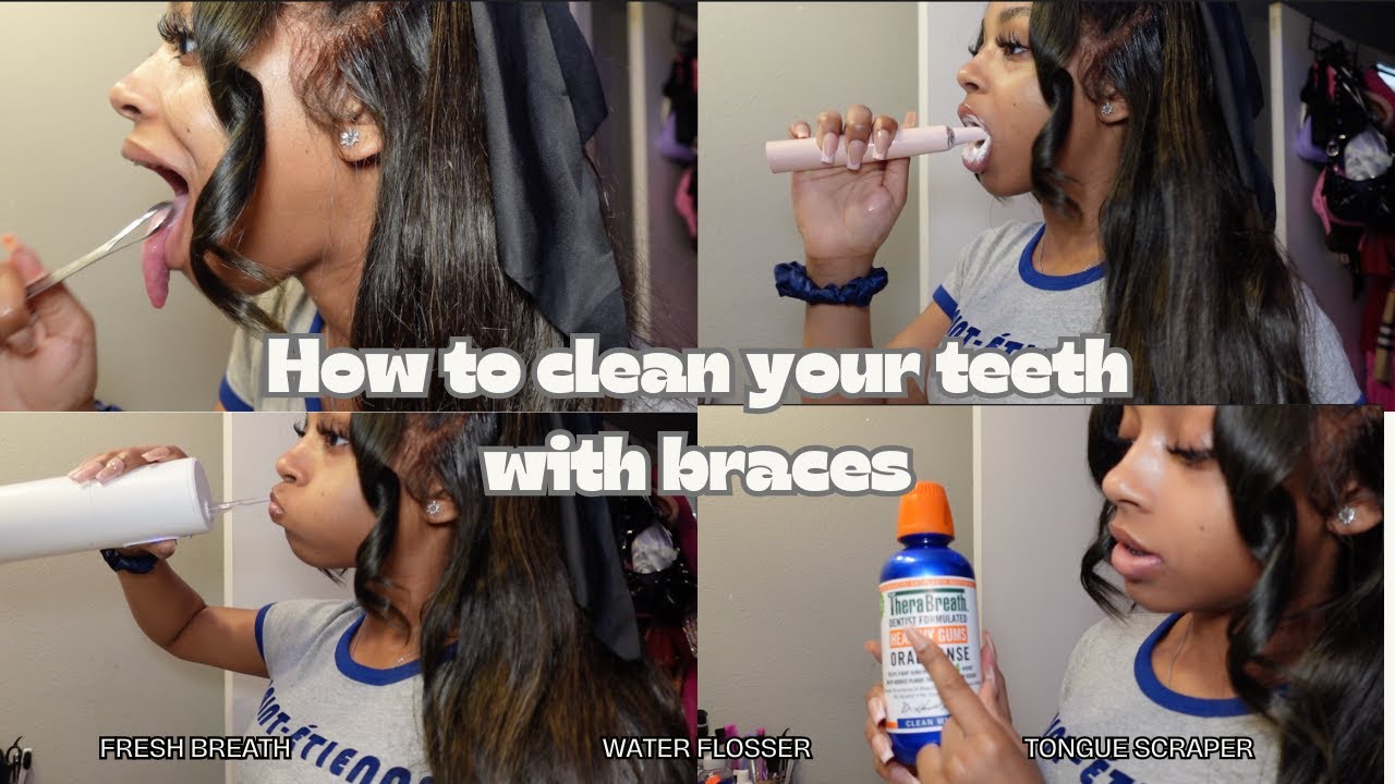 HOW TO CLEAN YOUR TEETH WITH BRACES | My Routine 😬 - YouTube
