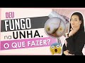 O QUE FAZER SE DER FUNGO NA UNHA DA CLIENTE | Criando a sua Base