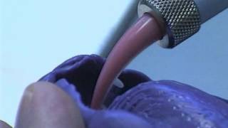 Celebrity SingleTooth-RN-Solid_en.mpg Profile