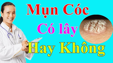 [ Trả Lời ] Mụn Cóc Có Lây Không ?