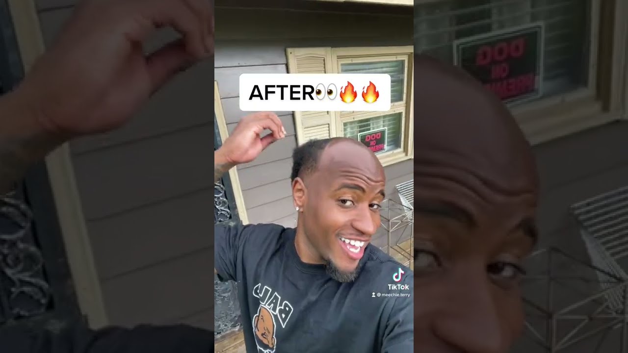 Meechie Bald Head Fresh HairCut 