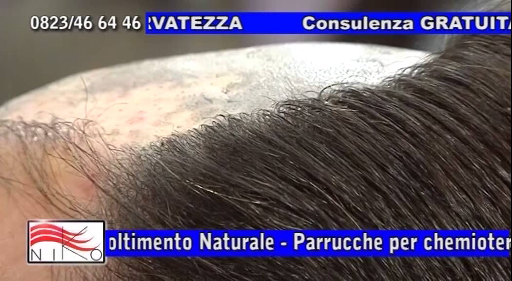 Protesi capelli naturali a/in Caserta;