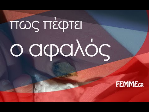 Βίντεο: Μπορείτε να κάνετε μπάνιο ένα μωρό με ομφαλικό κοκκίωμα;