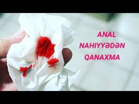 Anal çat yoxsa babasil? - Qanaxmanın səbəbi BUDUR