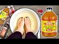 Soak Your Feet In Apple Cider Vinegar! The Results Will Amaze You! THIS is NOT A JOKE