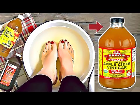 Soak Your Feet In Apple Cider Vinegar! The Results Will Amaze You! THIS is NOT A JOKE