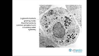 Ask the Expert - Part 3: How does Legionella grow?
