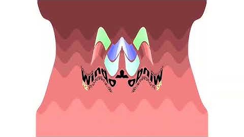 Windows XP R2 Professional Startup Sound Effects (SBP1982E) In G Major 847 In Confusión