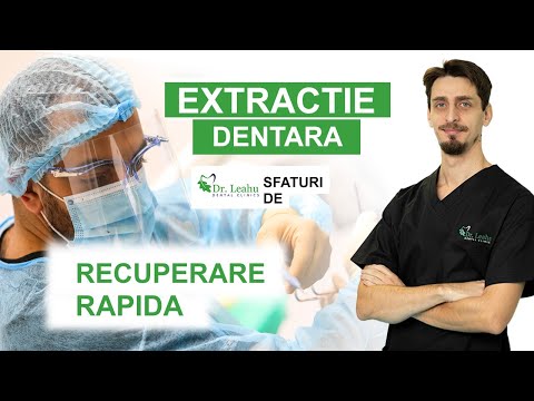 Video: Cum se vindecă gingiile după o extracție a dinților (cu imagini)