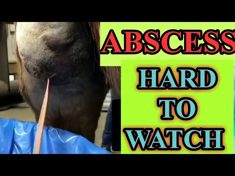 ABSCESS ON THIGH ( HARD TO WATCH ) | LOTS OF PUS FROM HUGE ...