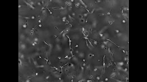 Time Lapse Video of MSC in a PEG Fibrinogen Hydrogel