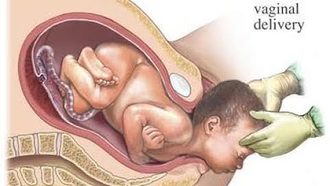 Vaginal delivery CPT code - simplify medical coding