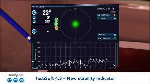 TactiCath Contact Force ablation catheter