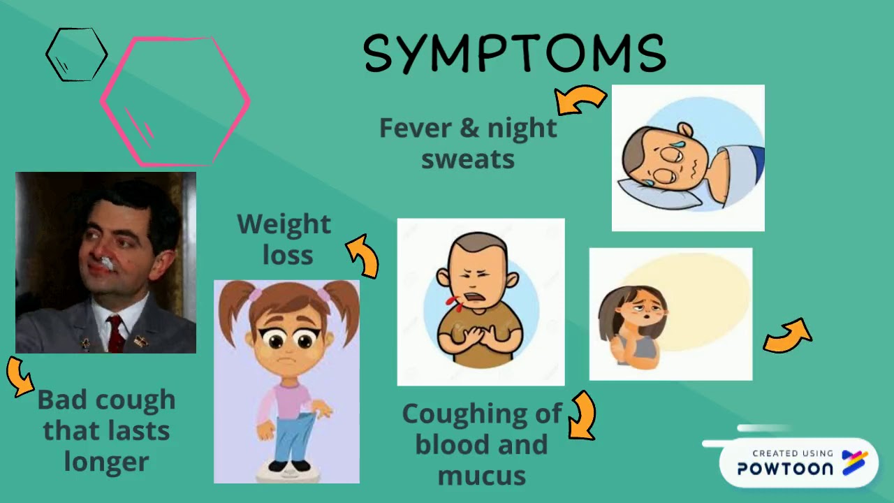 TUBERCULOSIS