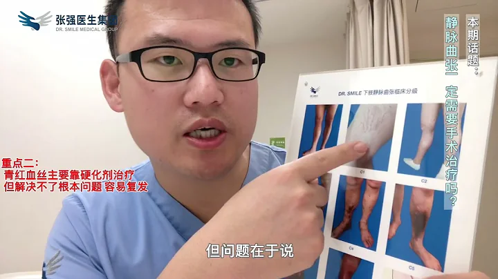 静脉曲张一定要手术治疗吗？│ #张强医生集团 #chiva #静脉曲张 #varicoseveins #DrSmileMedicalGroup - 天天要闻