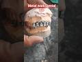 metal ceramic and DMLS work #shortsfeed #dentalartistry #dentist #dentist #dentalassistant #dentalwo