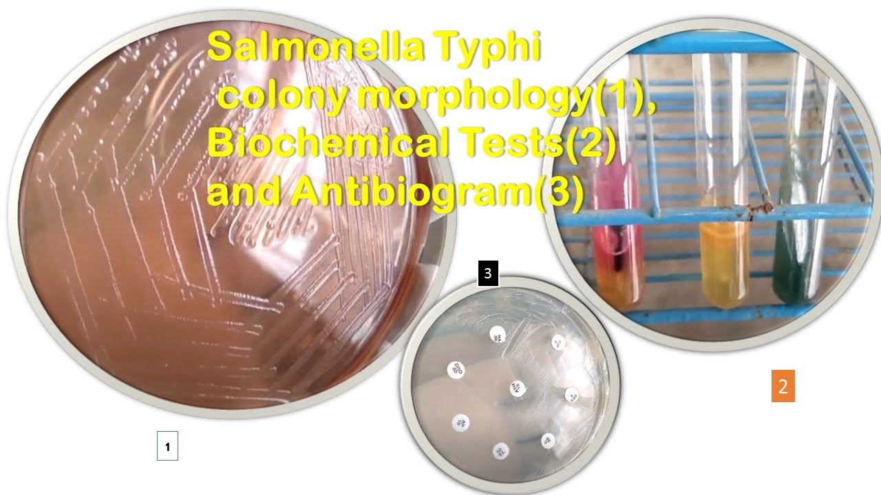 Salmonella Typhi colony morphology, Biochemical Tests and Antibiogram