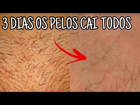 Vídeo: 3 maneiras de se livrar dos pêlos indesejados