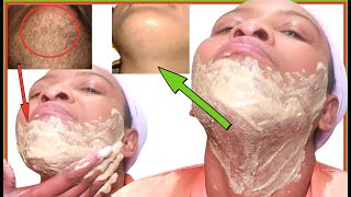 HOW I REMOVE FACIAL HAIR IN 5 MINUTES, HAIR WILL NOT GROW BACK FAST, CHIN, LIPS, AND JAWLINE