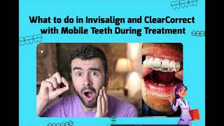 How to Handle Mobility During Invisalign and ClearCorrect Treatment