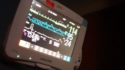 Talking about the Phillips Intellivue