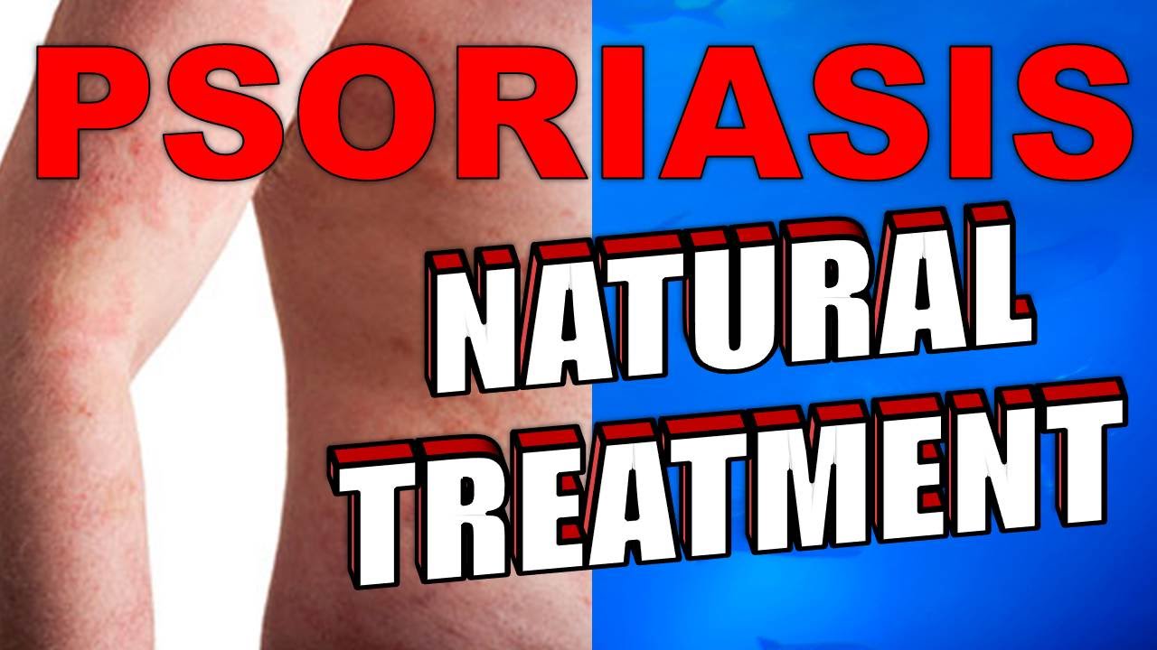 Natural Remedies For Psoriatic Arthritis Natural Remedies For Psoriatic Arthritis