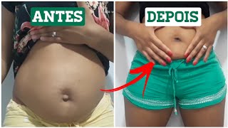 Fiz cirurgia de hérnia inguinal e umbilical quanto tempo depois eu