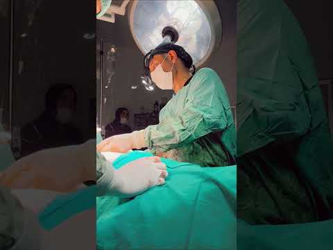 Mummy Makeover - Tummy Tuck and Breast Lift by Prof.Dr. Bekir ATİK