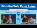 2 Month Typical & Atypical Development | Baby Motor Development Exam