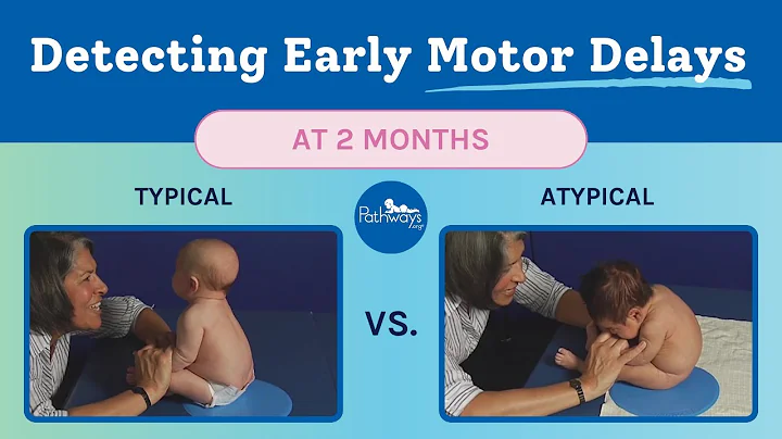 2 Month Typical & Atypical Development | Baby Motor Development Exam