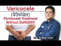 Varicocele      best doctor for varicocele  best treatment of varicocele