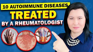 Top 10 Autoimmune Diseases A Rheumatologist Diagnose and Treat