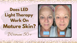 Does LED Light Therapy Work For Mature Women? | #myresults #womenover50