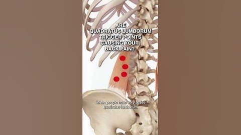 Are Quadratus Lumborum Trigger Points Causing Your Back Pain?