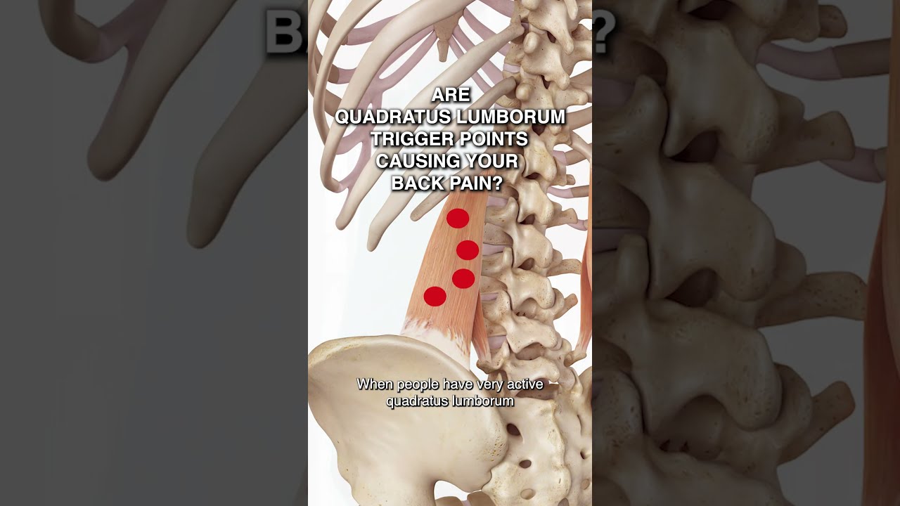 Are Quadratus Lumborum Trigger Points Causing Your Back Pain 