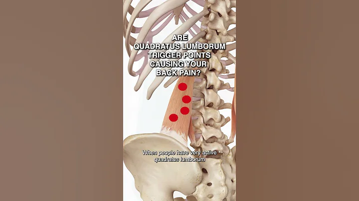 Are Quadratus Lumborum Trigger Points Causing Your Back Pain?