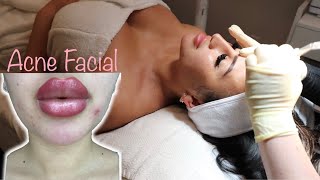 EXTREME Facial At VH SkinCare | PABLEZYY \& STEPHIE