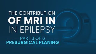The contribution of MRI in Epilepsy | Part 3 Presurgical Planning