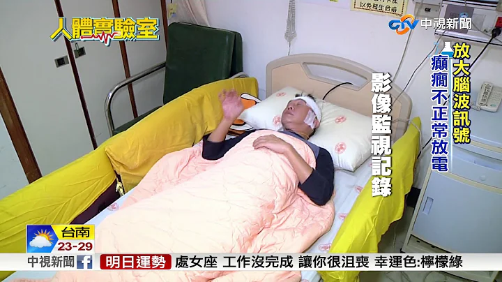 神經細胞造反 腦電圖揪癲癇元兇│中視新聞 20171106 - 天天要聞