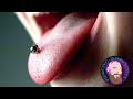 The REAL Danger of a Tongue Piercing